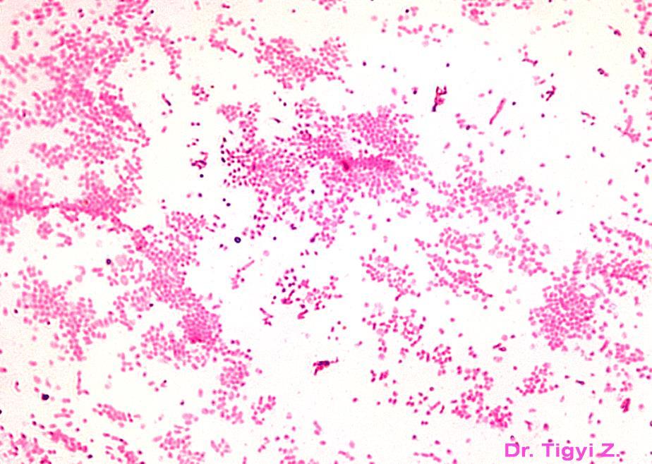 Staphylococcus aureus, Gram