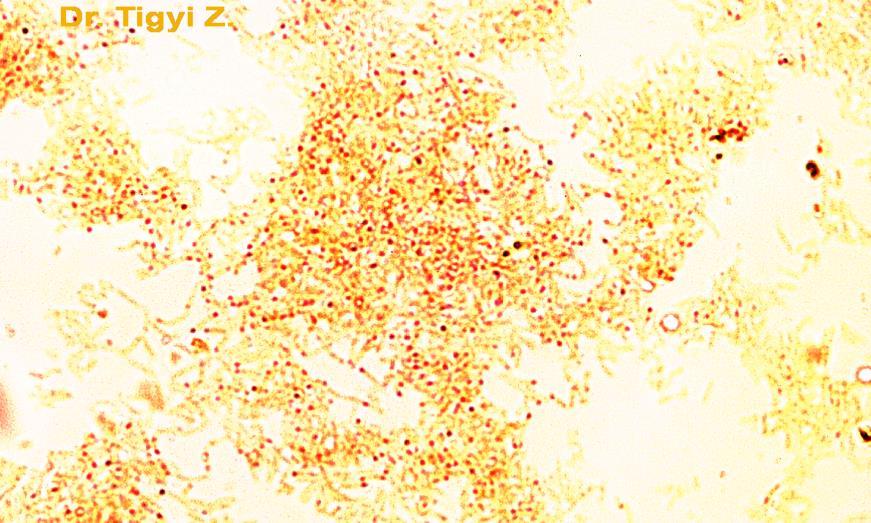 Neisser s staining Corynebacterium diphtheriae, was stained according to Neisser.