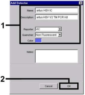 14. ábra: Belső kontroll (IC) detektor létrehozása (Detector Manager).