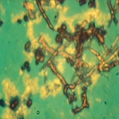 ELISA módszerrel több légmicélium képzésre képes Streptomyces törzsben kimutatták a C faktor termelését (Szeszák és mtsai, 1990), azonban a Streptomycesekben való széles körű elterjedését a Southern