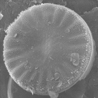 Cyclotella meduane,