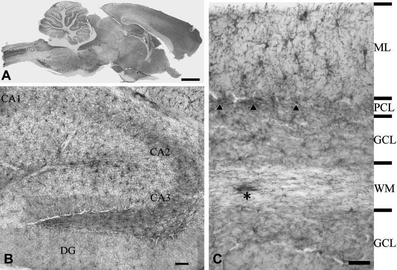 NG2 sejtek ( NG2 glia ) synantocytes NG2-expresszáló glia (synantocita) a felnőtt agyban.