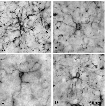 NG2+ sejtek, ezüsttel intenzifikált DAB festés (dark granules on the surface and in the