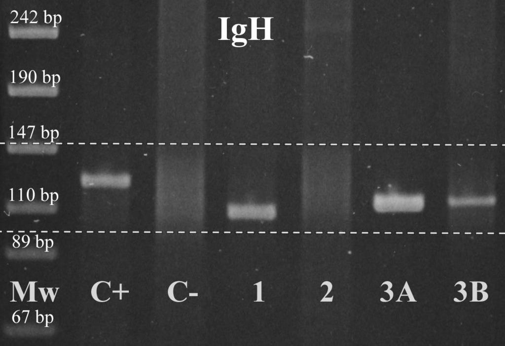 3.4 3.4.1. ábra A három PTCL-ban észlelt morfológiai, immunhistologiai és in situ hibridizációs leletek. /folytatás/ n-p 1. sz.