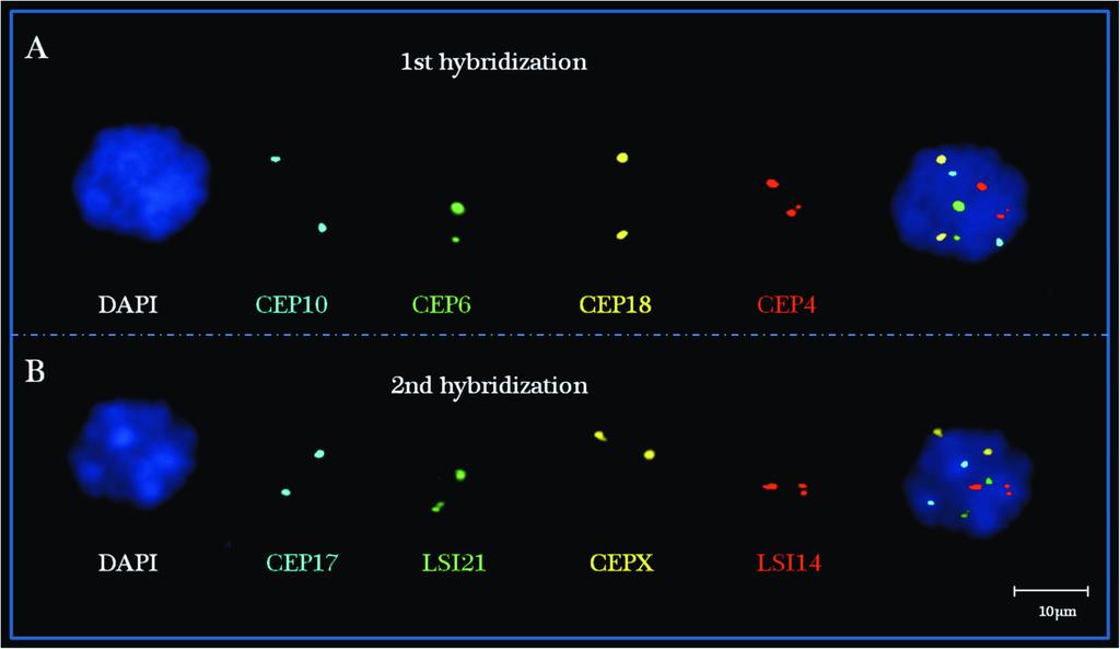 3.1 3.1.1. ábra A target sejt egymást követő, 2 x 4 ifish jelölése. A az első próbaszet (CEP szet) CEP4 (vörös), CEP6 (zöld), CEP10 (aqua), CEP18 (arany); B ugyanazon target rehibridizációja a 2.