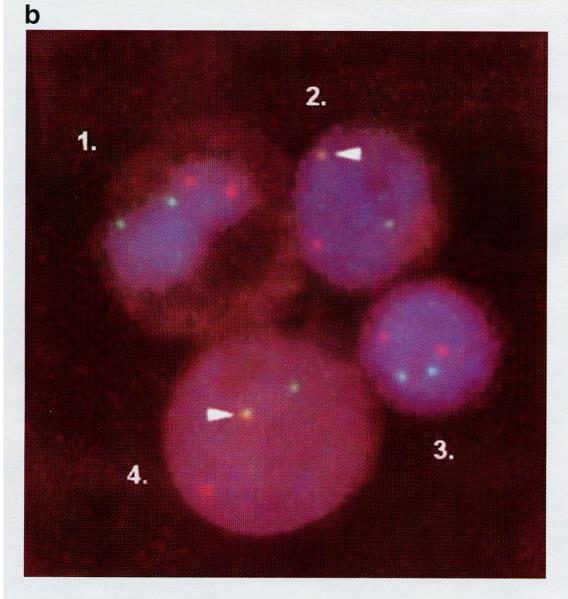 1. ábra a érett myeloid sejt (1), reaktív lymphocyta (3) valamint két lymphoblast (2, 4) fénymikroszkópos képe, HE festés, x