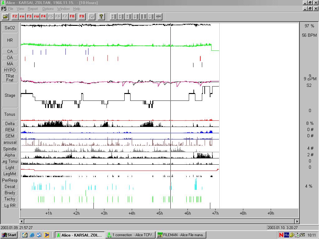 RLS-PLMD