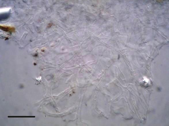 Inocybe Mt 1. (HU 301): a) külső ill.