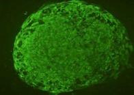 Humán embrionális őssejt-vonalak létrehozása ES sejt kolónia IVF megsemmisítés