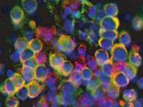 Cells with properties of pancreatic -like cells