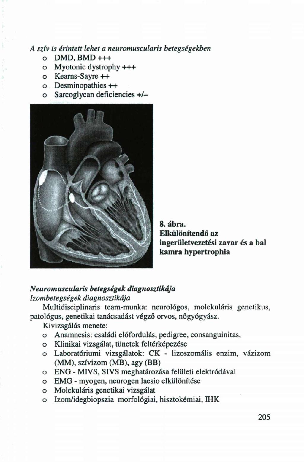 A szív is érintett lehet a neurmuscularis betegségekben DMD, BMD +++ Mytnic dystrphy +++ Keams-Sayre ++ Desminpathies ++ Sarcglycan deficiencies +/- 8. ábra.