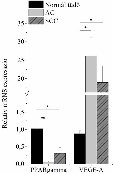 9. ábra: PPARgamma és VEGF-A génexpresszió vizsgálata AC (n=11) és SCC (n=12) betegekből származó mintákban, normál