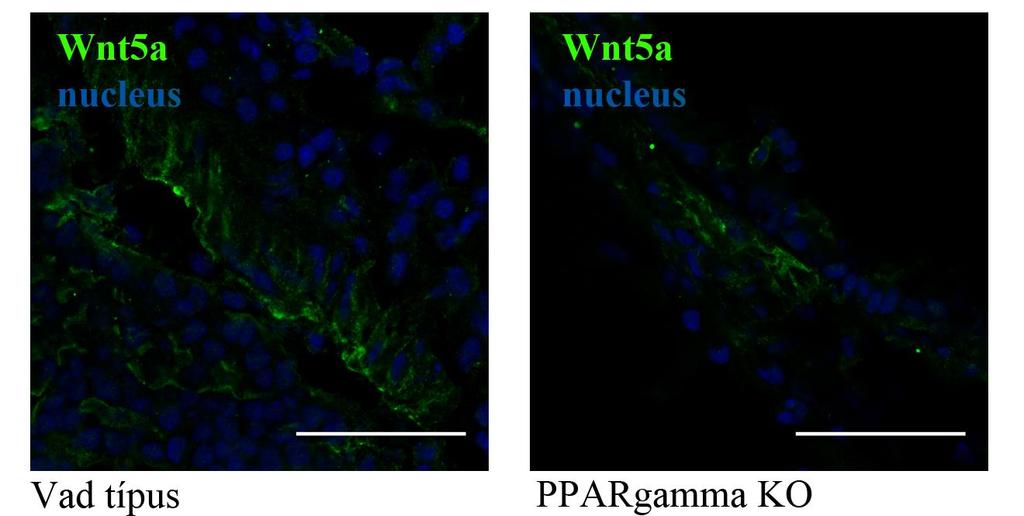 festése szintén ezt hangsúlyozza, mivel a PPARgamma ilyen rendszerben történő alul működése nem jár a Wnt5a molekula fehérjeszintű változásával (14. ábra). 14.