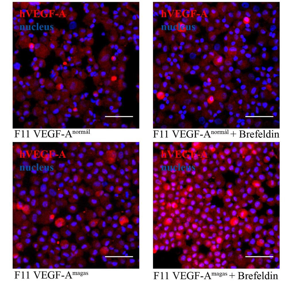 18. ábra: VEGF-A overexpresszió és szekréció. 20x-os nagyítás, lépték 50 µm. 4.6 mikrorns-ek szerepe az angiogenezisben Az eddigi eredményeink egy érdekes kérdést vetettek fel.