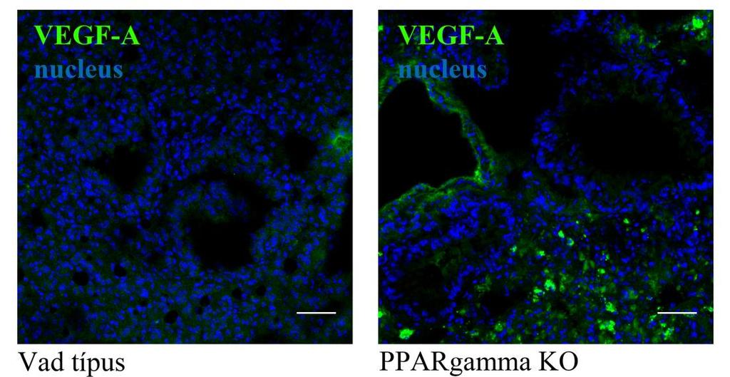 26. ábra: VEGF-A kifejeződésének vizsgálata PPARgamma KO és vad típusú egér tüdőmetszeteken. A képek 3 különböző egér tüdejéből kiválasztott reprezentatív képek.