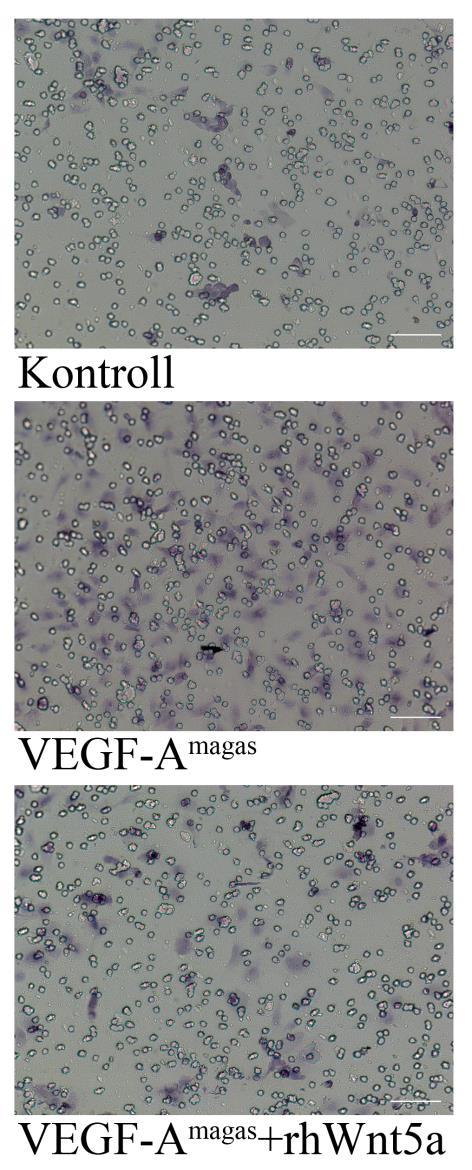 32. ábra: VEGF-A és Wnt5a hatásának vizsgálata endotélsejtek