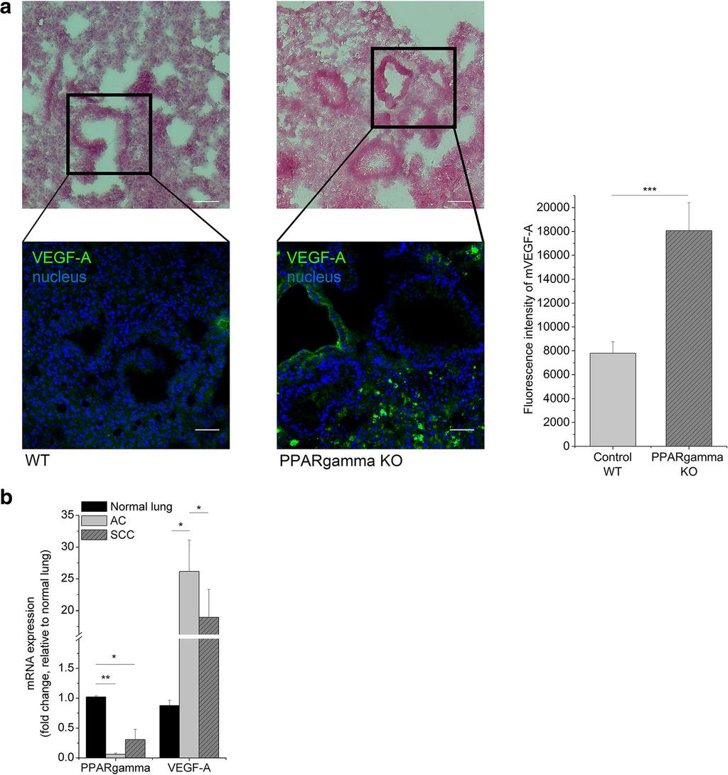 Rapp et al. BMC Cancer (2016) 16:915 Page 7 of 16 Fig. 1 VEGF-A expression in PPARgamma KO mice and human lung tumors.