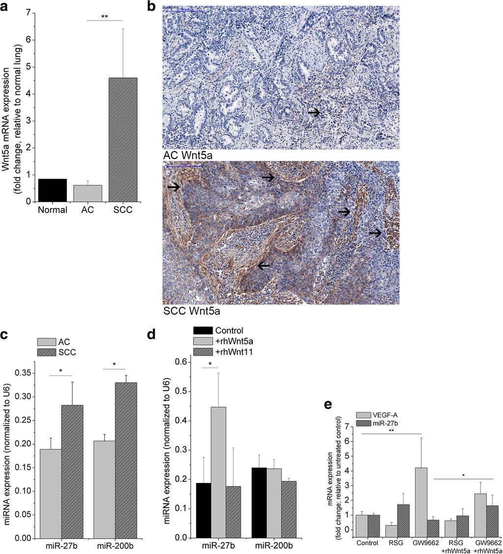 Rapp et al. BMC Cancer (2016) 16:915 Page 10 of 16 Fig. 3 Transcript analysis of Wnt5a, mirna and VEGF-A in primary human lung cancer samples of AC and SCC and 3D in vitro lung aggregate cultures.