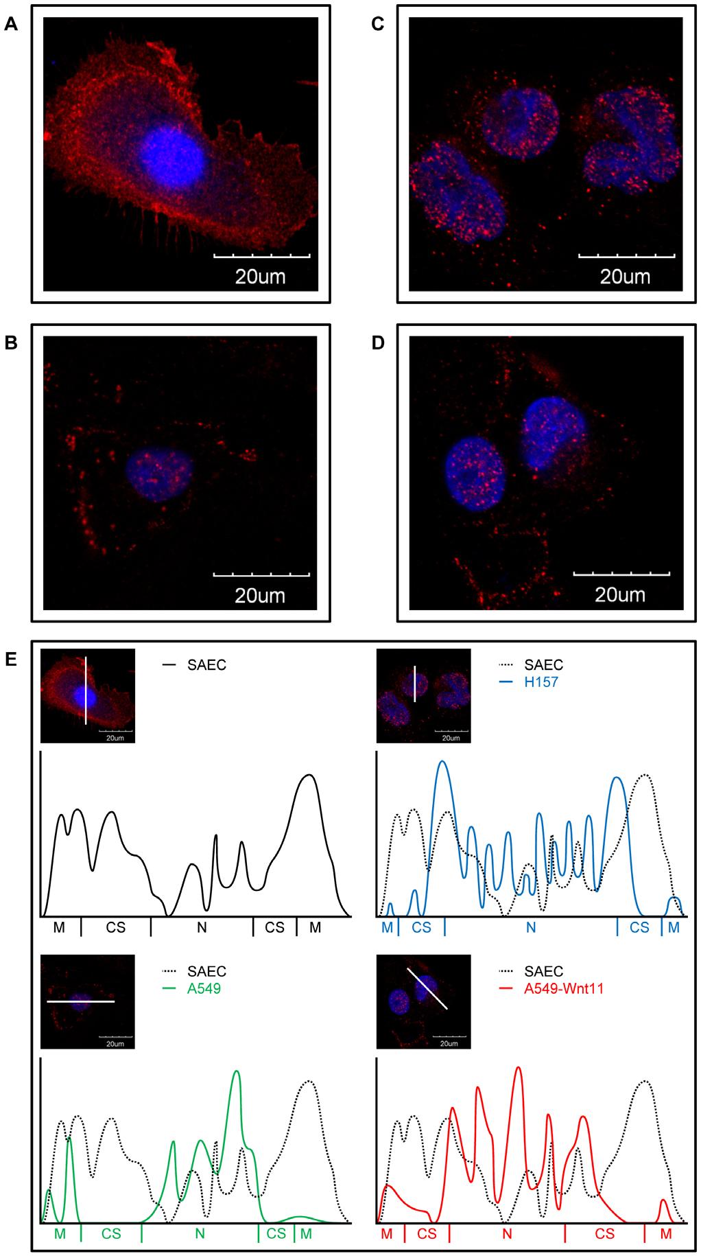 Wnt Signalling in Squamous Cell Lung Carcinoma PLOS