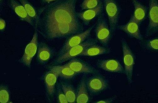 Fluoreszcens immunhisztokémia SLE