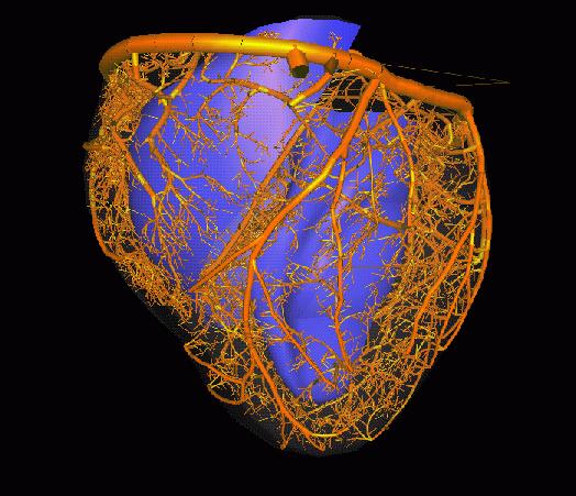 A CORONARIA COLLATERALISOK A normál szívek többségében congenitalisan jelen vannak szűk intercoronariás csatornák (100 μm).