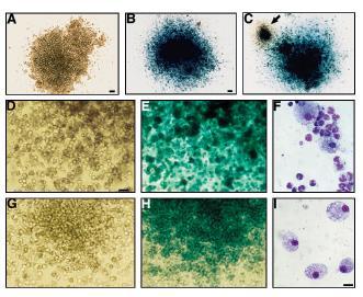 1. NSC (neural stem cell) izolálás LacZ+ ROSA egerekből b-gal ROSA -> in vitro