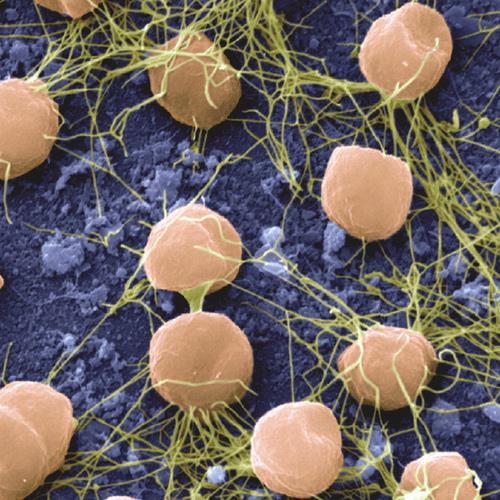 (actinomycetes) - termofil baktériumok (Pyrobaculum, a Pyrodictium, a