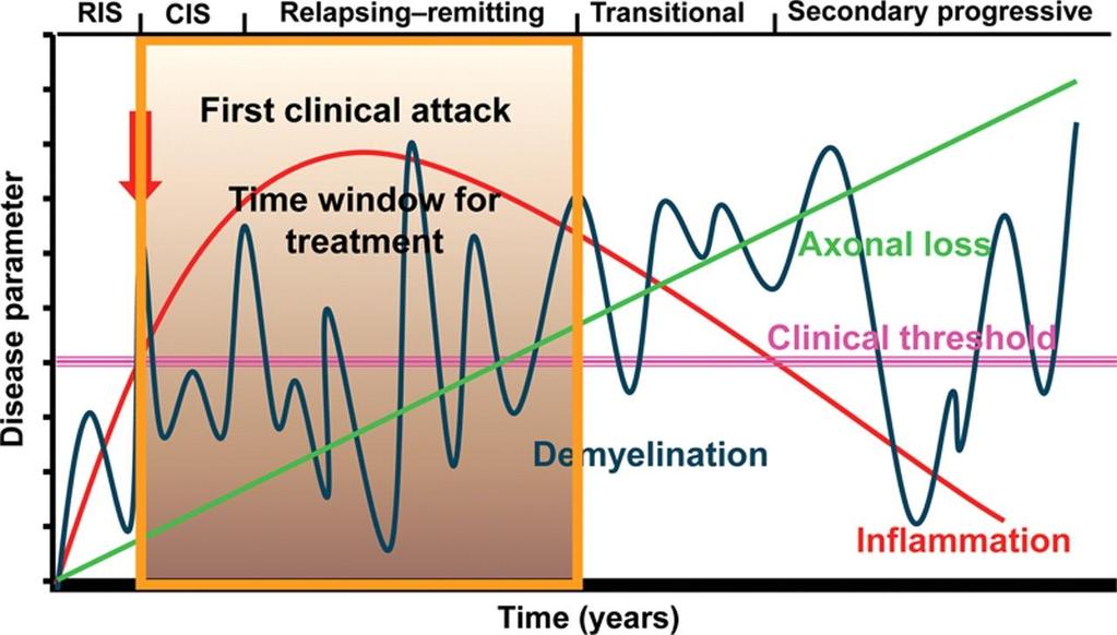 Az SM patológiai és klinikai lefolyása Mikor tudunk kezelni? A terápiás ablak ScalfarciA et al:brain.