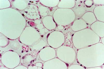 A zsirszövet endokrin szerv PAI-1, Angiotensinogen, IGF-1, TGF-β Leptin Adiponectin