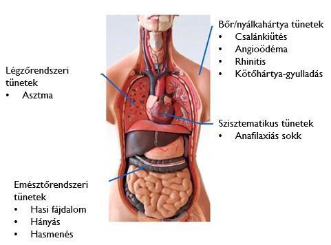 AZ ÉLELMISZER-ALLERGIÁRÓL ÁLTALÁBAN ÉLELMISZEREKKEL SZEMBEN JELENTKEZŐ TÚLÉRZÉKENYSÉGI REAKCIÓK TOXIKUS (mindenkit érint) NEM TOXIKUS (csak az érzékeny egyéneket érinti) ELSŐDLEGES TÚLÉRZÉKENYSÉGI