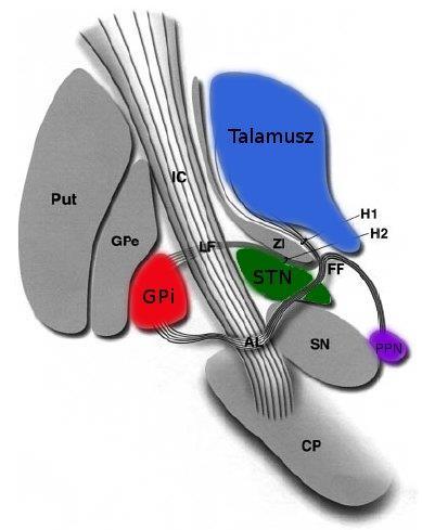 Sebészi célpontok Thalamus Vim: tremor Voa, Vop: tremor, dystonia (?) Nucl. anterior: epilepszia (?) CM: epilepszia (?) CM+Pf: Guilles de la Tourette (?