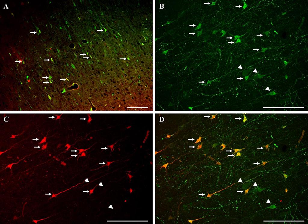 Farkas et al. The Consequences of Mechanoporation in DTBI J. Neurosci.