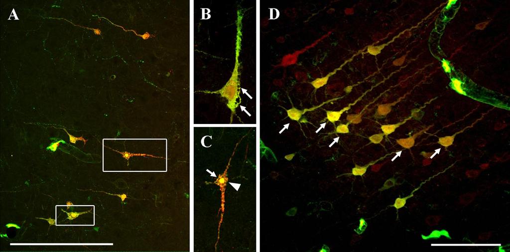 Densitometric evaluation of injured neurons showing different dextran uptake profiles could not be performed, considering the high and variable background level of the fluorophores associated with