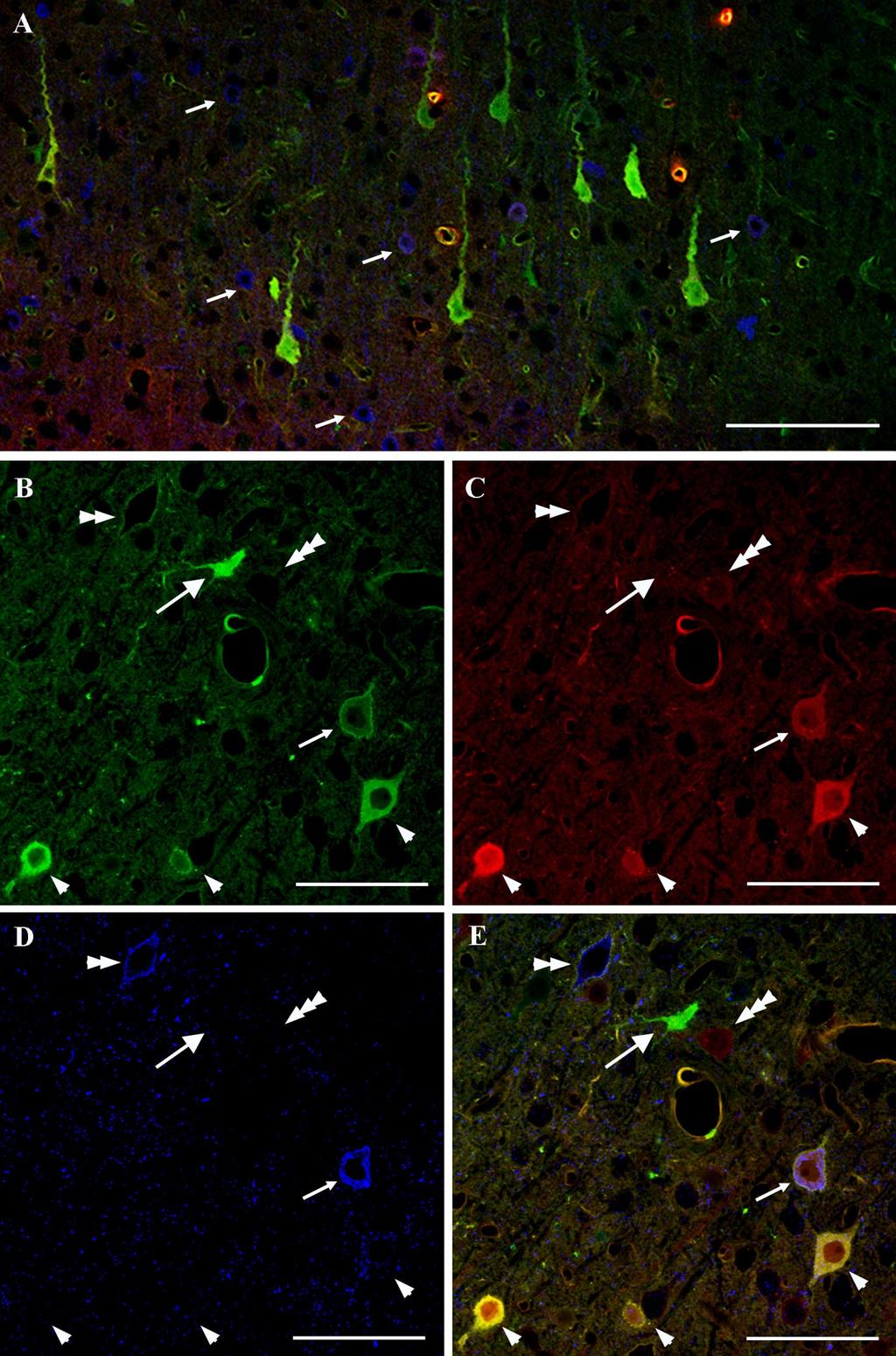 Farkas et al. The Consequences of Mechanoporation in DTBI J. Neurosci., March 22, 2006 26(12):3130 3140 3135 Figure 6.