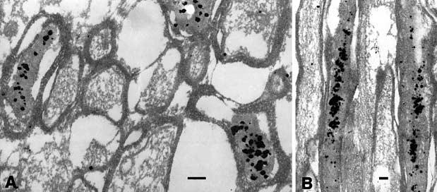 Note that the normal-looking axon profiles do not contain silver grains. Bar 500 nm Fig.