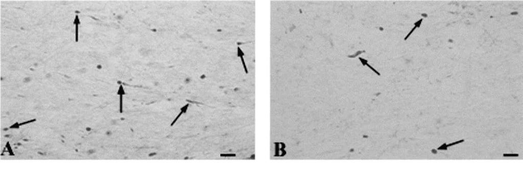 BUKI ET AL. tion of the immunohistochemical complex using 0.05% diaminobenzidine (DAB; Sigma) and 0.01% hydrogen peroxide in 0.1 M phosphate buffer.
