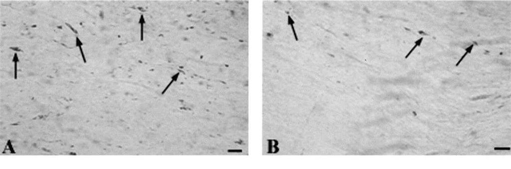 CALPAIN INHIBITOR PREVENTS TRAUMATIC AXONAL INJURY scattered axons localized in the CSPT and MLF.