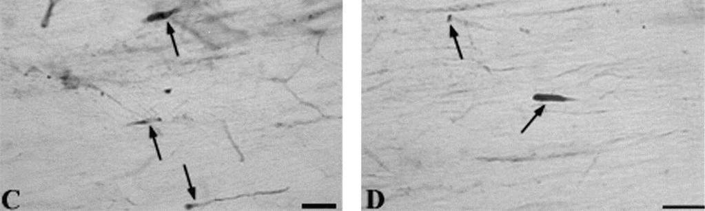 consistent with previous descriptions of damaged axonal profiles 2 h post-injury (Stone et al., 1999; Buki et al., 1999a,c). The sham-injured animals displayed no immunoreactive axonal profiles.