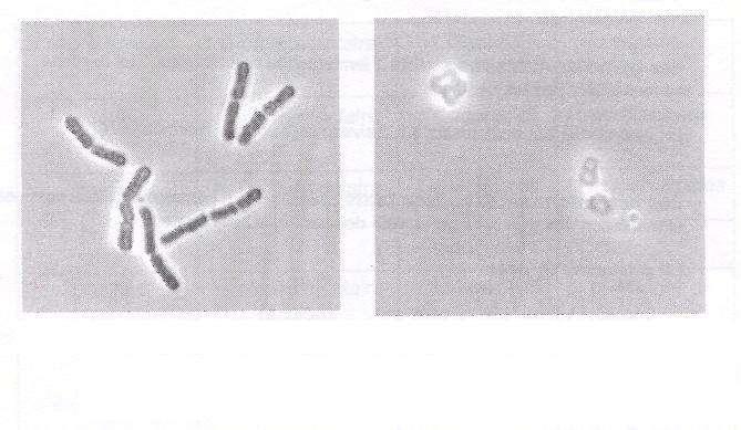 Lactobacillus sp. Pediococcus sp.