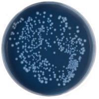 Legionella kimutatása Legionella kimutatása