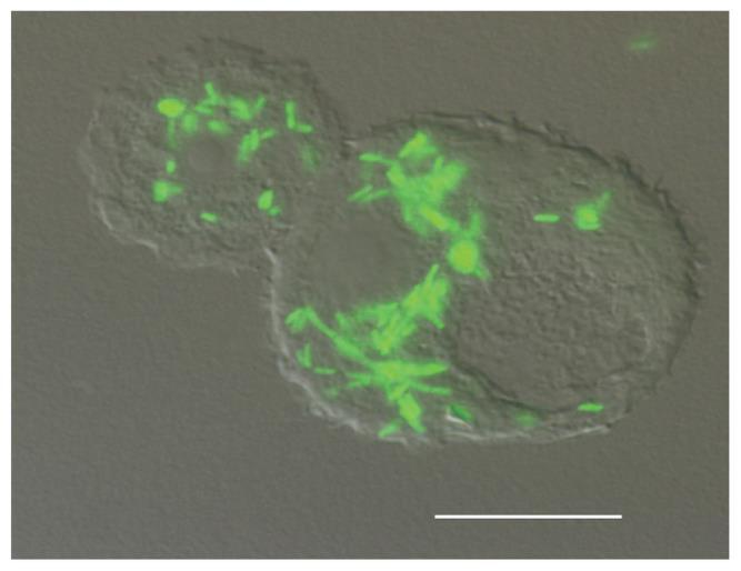 Legionella baktérium Legionellaceae család, Legionella genus Jelenleg 62 Legionella faj ismert (23 okoz megbetegedést) A leggyakoribb humán patogén: L.