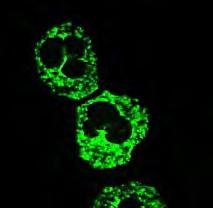 Pozitivitása a betegség aktivitásával, lupus nephritis elfordulásával korrelál P-Ribosoma at. 7.