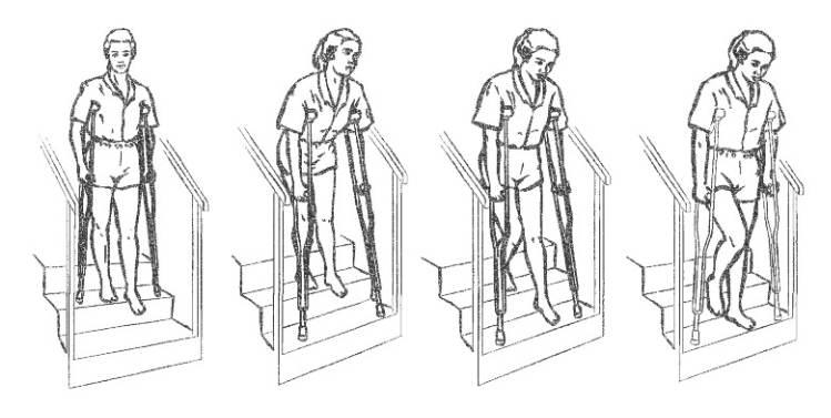 Lépcsın járás, leülés, felállás Lépcsın járáskor fölfelé az ép láb sérült