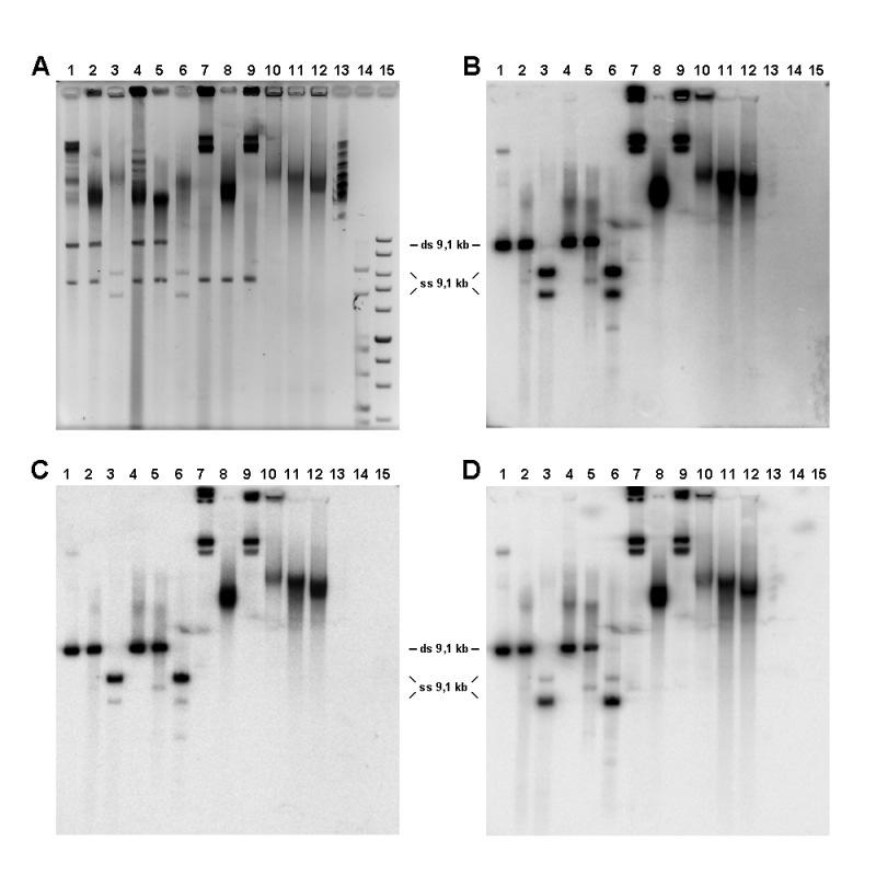 10. ábra: S. cerevisiae rdns-ének vizsgálata Southern blottal. A. EBr-festett agaróz gél 1. Sfi I emésztett WDHY199 blokk; 2. Sfi I és S1 nukleáz emésztett WDHY199 blokk; 3.