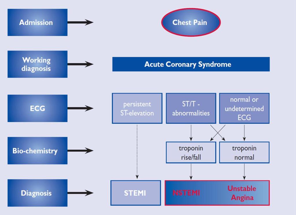 Akut coronaria syndromák Troponin pozitív = myocardialis infarctus (az ST elevatios szinte mindig,