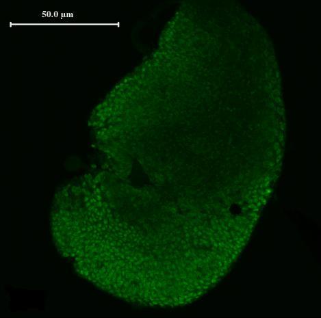 Lack of dutpase in Drosophila larvae Western