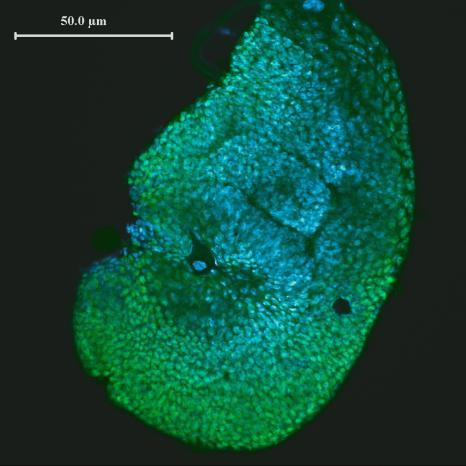 Larvae have two types of tissues - larval -