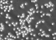 nm dasatinib Szétterült sejtek (%) Szétterült sejtek (DMSO kontroll %-ában) 8 6 4 2 1 75 5