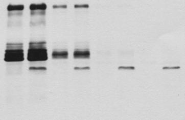 ábra). A dasatinib eredményesen csökkentette a neutrofil granulociták szekunder granulumának, a laktoferrinnek az ürülését is (IC 5 : 49 nm), melyet ELISA-módszerrel detektáltunk (2. ábra).