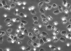 6.2.3 A dasatinib hatásának vizsgálata a neutrofil granulociták immunkomplex által kiváltott